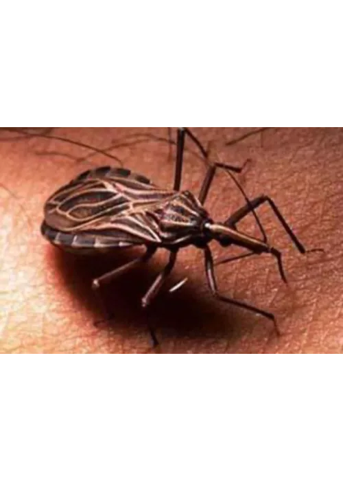 Trypanosoma cruzi.