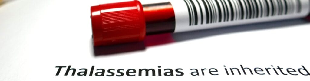 Talasemia
